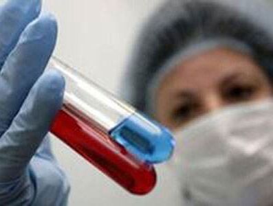 全自动2024海角官网首页有哪些检测方法？