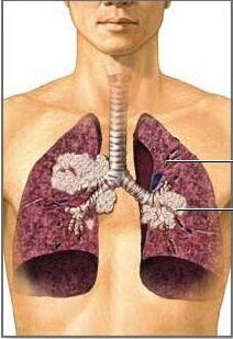 医用海角社交入口APP肺癌与微量元素的密切关系