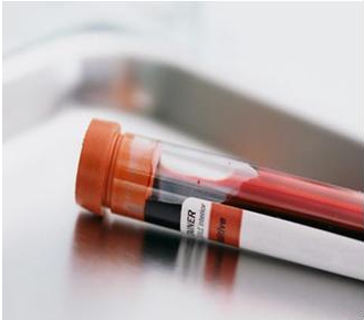 用血液检测2024海角官网首页器